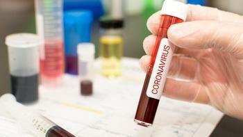 coronavirus-in-florida:-confirmed-covid-19-cases-and-where-they-are-located